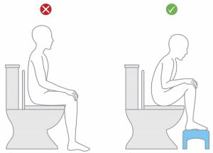 نحوه نشستن صحیح روی توالت فرنگی