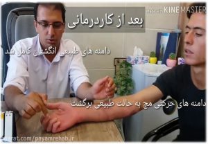 درمان ارتوپدی دست