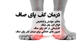 درمان کف پای صاف